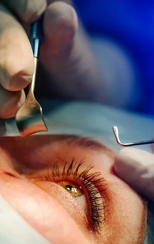 Medical eye care at Stites Eye Care